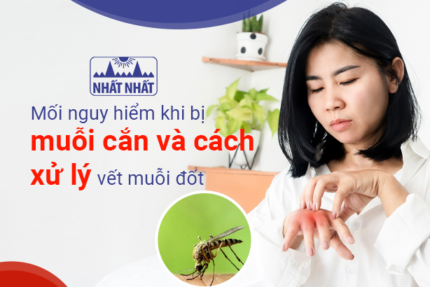 Mối nguy hiểm khi bị muỗi cắn và cách xử lý vết muỗi đốt