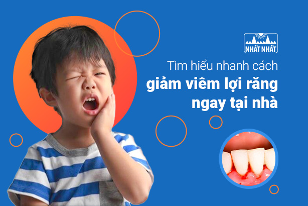 Tìm hiểu nhanh cách giảm viêm lợi răng ngay tại nhà