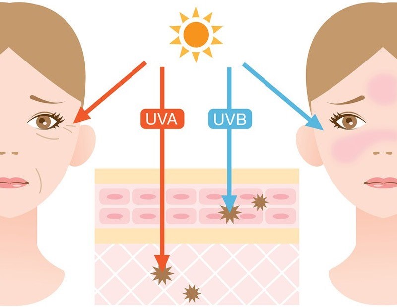 Trong ánh nắng mặt trời có chứa 3 loại tia là: UVA, UVB, UVC