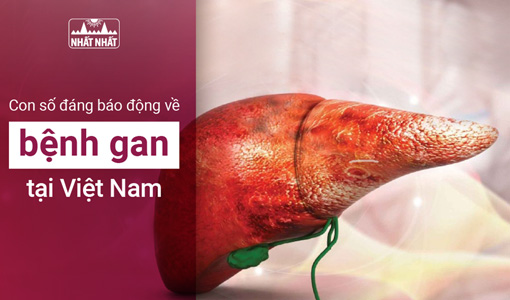 bệnh gan tại Việt Nam