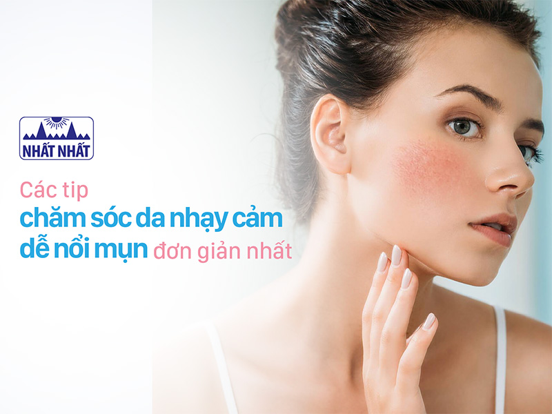 da nhạy cảm dễ nổi mụn