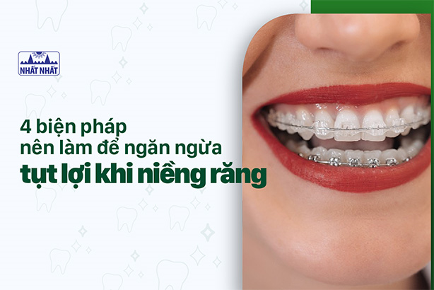 4 biện pháp nên làm để ngăn ngừa tụt lợi khi niềng răng