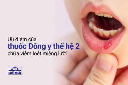 Ưu điểm đặc biệt của thuốc Đông y thế hệ 2 chữa viêm loét miệng lưỡi