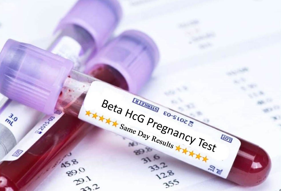 Xét nghiệm máu là phương pháp xác nhận dấu hiệu có thai sau 1 tuần hiệu quả nhất.