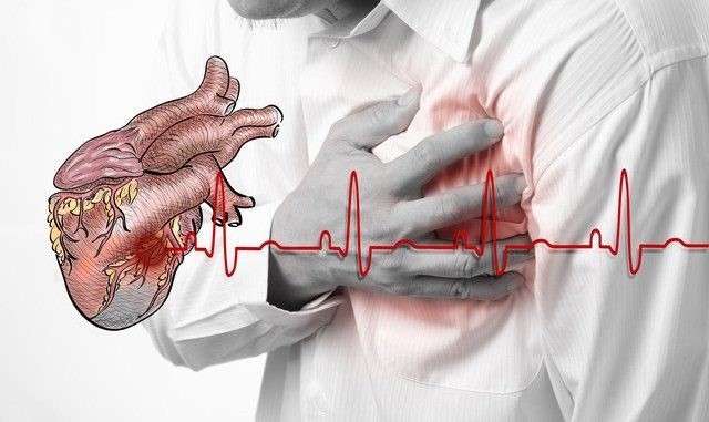 Bệnh lý tim mạch làm tăng nguy cơ đột quỵ não