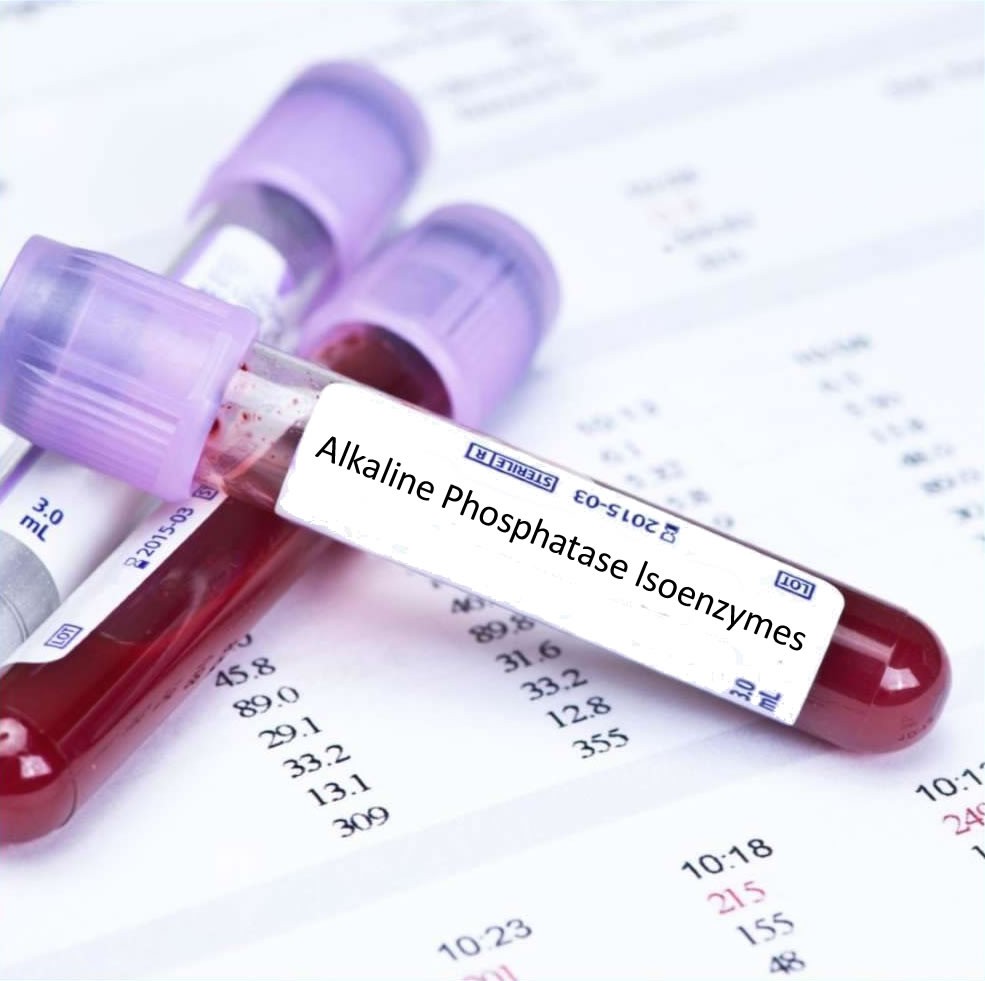 Alkaline phosphatase có nguồn gốc ở gan và cả xương- kiểm tra chức năng gan