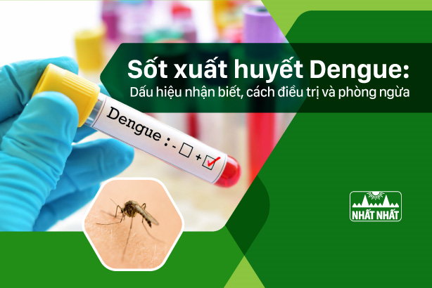 Sốt xuất huyết Dengue: Dấu hiệu nhận biết, cách điều trị và phòng ngừa