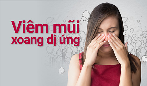 Viêm mũi xoang dị ứng: Dấu hiệu, chẩn đoán và dự phòng