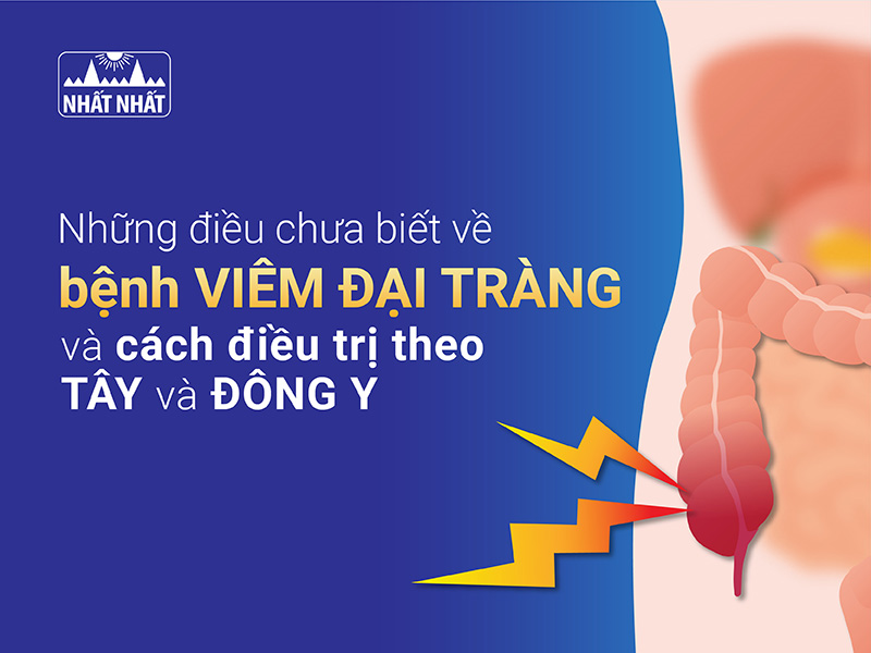 Bệnh viêm đại tràng và cách điều trị theo Tây và Đông y