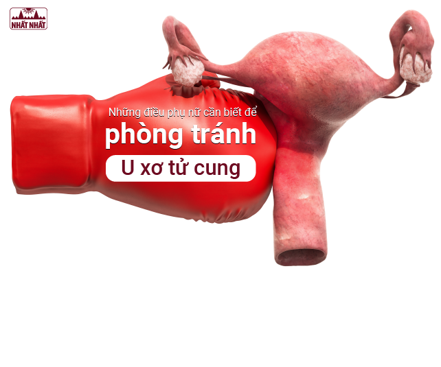Những điều phụ nữ cần biết để phòng tránh U xơ tử cung
