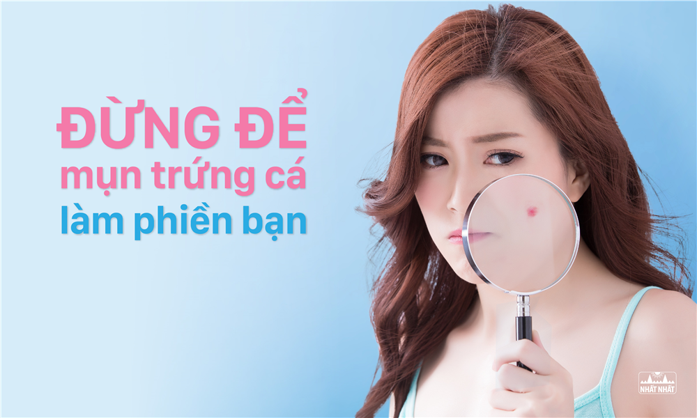 Đừng để mụn trứng cá làm phiền bạn