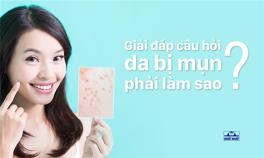 Giải đáp câu hỏi da bị mụn phải làm sao?