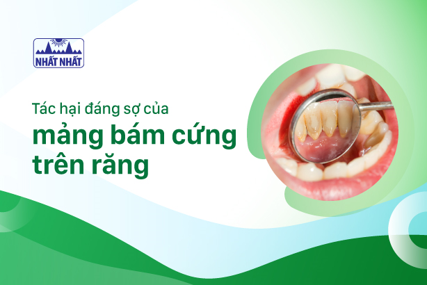 Tác hại đáng sợ của mảng bám cứng trên răng