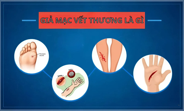 Giả mạc vết thương là gì: Tìm hiểu về lớp màng bảo vệ vết thương