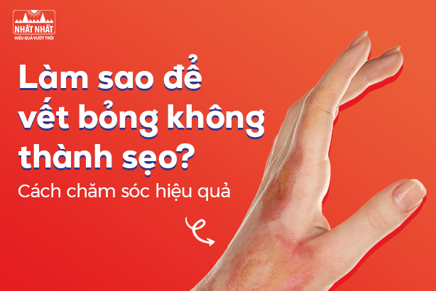 Làm sao để vết bỏng không thành sẹo? Cách chăm sóc hiệu quả