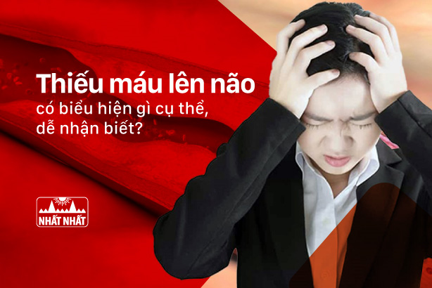 Thiếu máu lên não có biểu hiện gì cụ thể, dễ nhận biết?