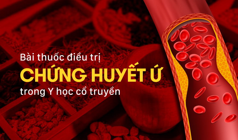 Bài thuốc điều trị chứng huyết ứ trong Y học cổ truyền