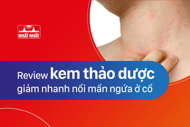 Review kem thảo dược giảm nhanh nổi mẩn ngứa ở cổ