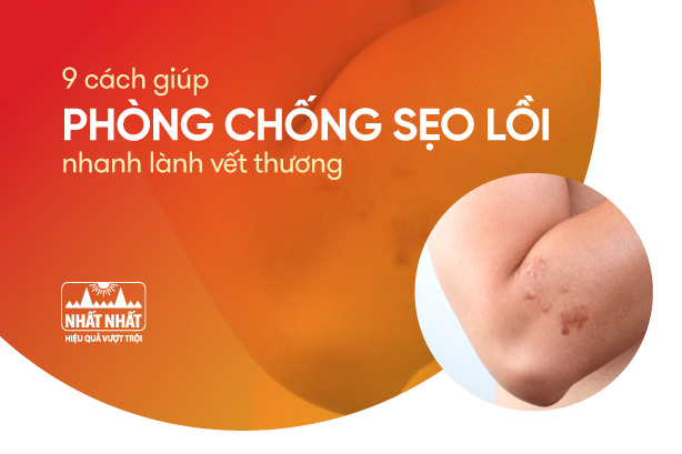 9 cách giúp phòng chống sẹo lồi, nhanh lành vết thương