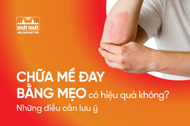 Chữa mề đay bằng mẹo có hiệu quả không? Những điều cần lưu ý