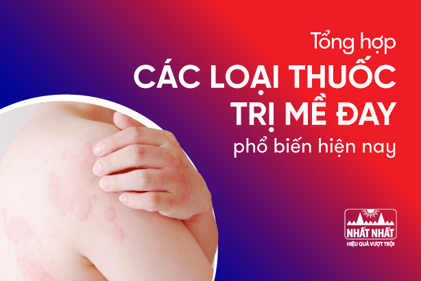 Tổng hợp các loại thuốc trị mề đay phổ biến hiện nay