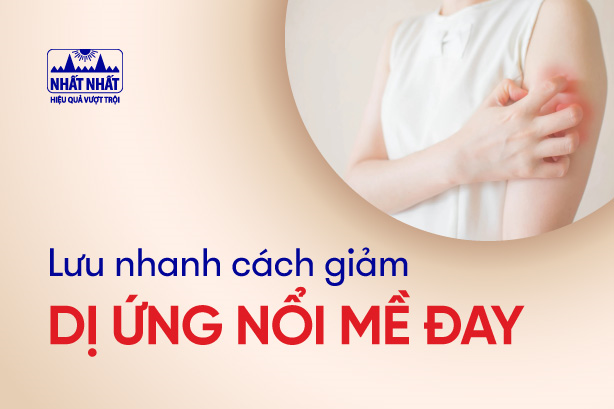 Lưu nhanh cách giảm dị ứng nổi mề đay ngứa ngáy