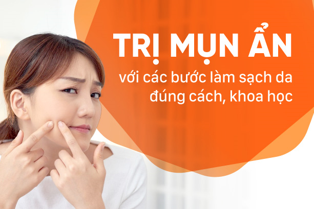 Trị mụn ẩn với các bước làm sạch da đúng cách, khoa học