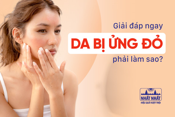 Giải đáp ngay: Da bị ửng đỏ phải làm sao?