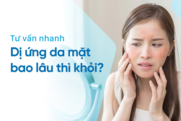Tư vấn nhanh: Dị ứng da mặt bao lâu thì khỏi?