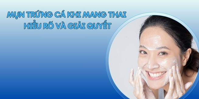 Mụn trứng cá khi mang thai: Hiểu rõ và giải quyết