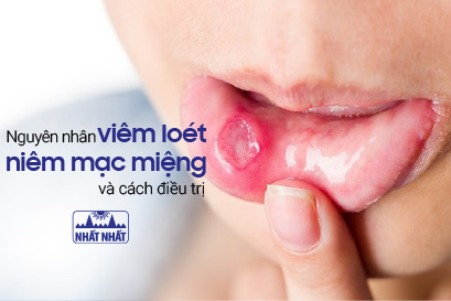 Viêm loét niêm mạc miệng sẽ không còn đáng sợ nếu biết cách!