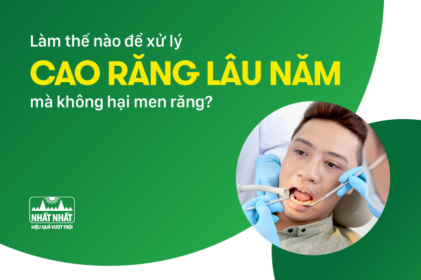 Làm thế nào để xử lý cao răng lâu năm mà không hại men răng?