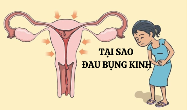 Tại sao đau bụng kinh? Nguyên nhân và cách cải thiện