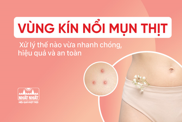 Vùng kín nổi mụn thịt: Hướng dẫn cách xử trí nhanh 