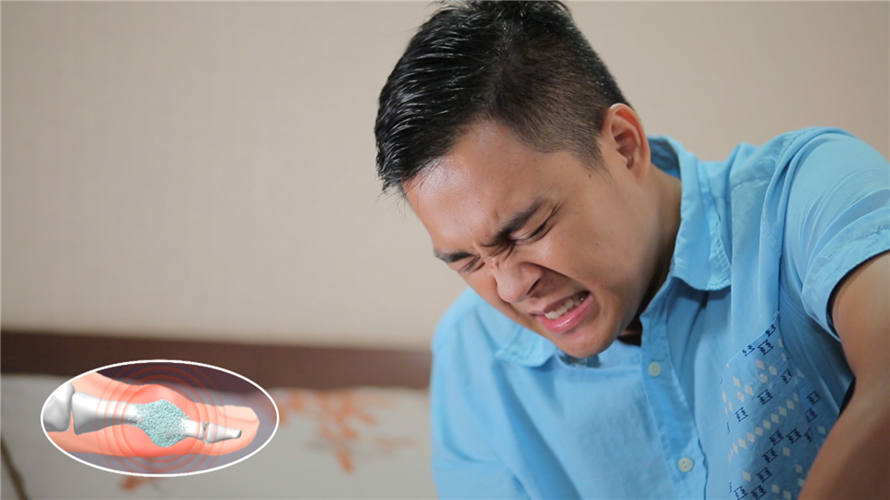 Điều trị triệt để bênh gút bằng bài thuốc bí truyền hiệu quả vượt trội
