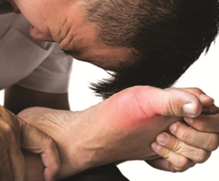 Dạng viên nén tiện dụng, Bài Thuốc Thống Phong (GOUT) Đông y thế hệ 2
ĐIỀU TRỊ TRIỆT ĐỂ BỆNH GOUT MẠN TÍNH