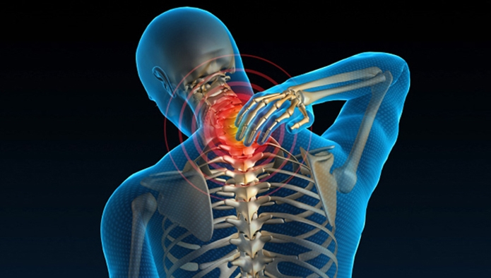 Điều trị thoái hóa, vôi hóa đốt sống cổ bằng bài thuốc bí truyền của dòng họ Hoàng