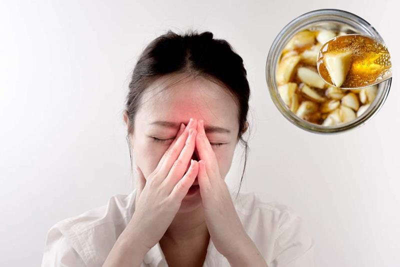 Tổng hợp các cách trị viêm xoang tại nhà an toàn, hiệu quả