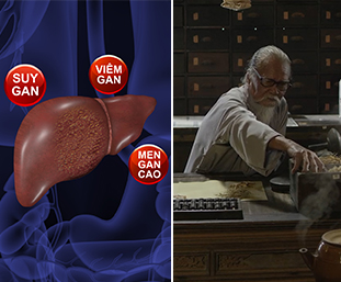 TRỊ VIÊM GAN, ĂN KHÔNG TIÊU, DỊ ỨNG, MỀ ĐAY, NÓNG TRONG, MỤN Bằng bài thuốc giải độc gan Đông y thế hệ 2 kỳ diệu