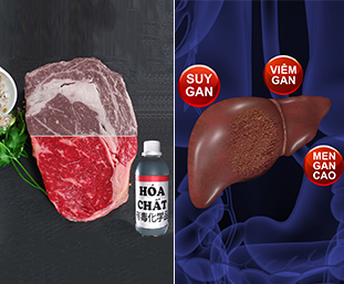 THUỐC ĐÔNG Y THẾ HỆ 2 GIẢI ĐỘC GAN, TRỊ VIÊM GAN DO THỰC PHẨM BẨN