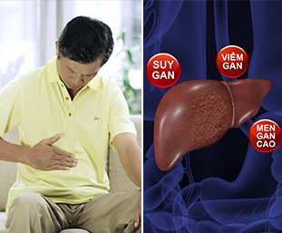 Bài thuốc giải độc gan Đông y thế hệ 2 kỳ diệu TĂNG CƯỜNG CHỨC NĂNG GAN CHO NGƯỜI GIÀ

