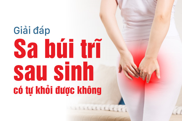 Giải đáp: Sa búi trĩ sau sinh có tự khỏi được không?