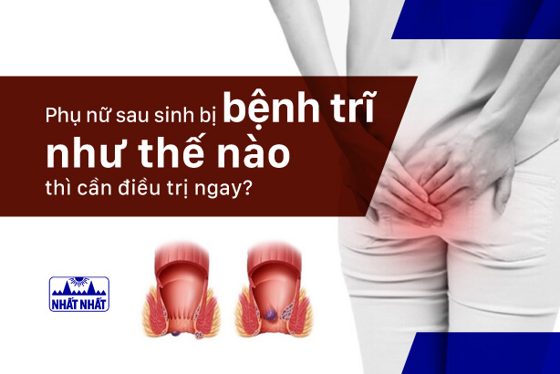 Phụ nữ sau sinh bị bệnh trĩ như thế nào thì cần điều trị ngay?