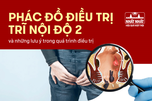 Phác đồ điều trị trĩ nội độ 2 và những lưu ý trong quá trình điều trị