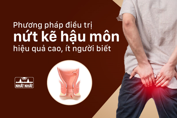 Phương pháp điều trị nứt kẽ hậu môn hiệu quả cao, ít người biết