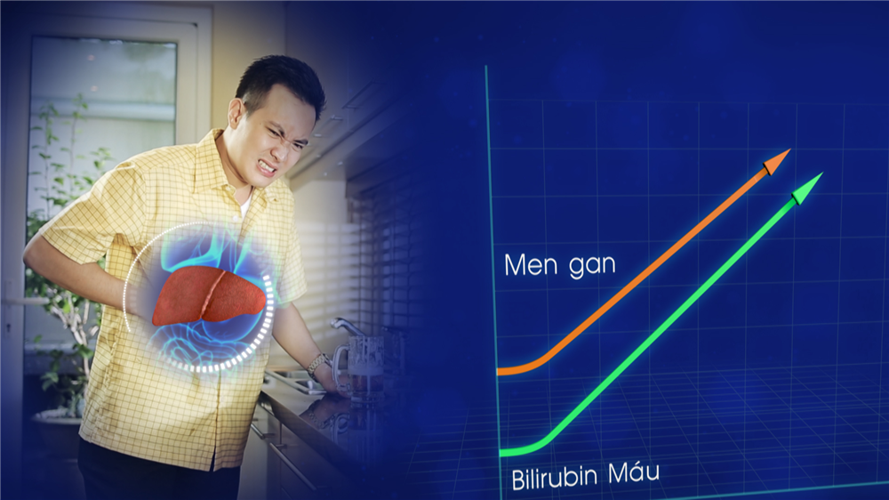 Điều trị viêm gan B, viêm gan virus bằng bài thuốc bổ gan tiêu độc Đông y thế hệ 2, hiệu quả vượt trội