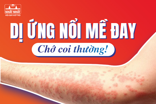Dị ứng nổi mề đay: Chớ coi thường!