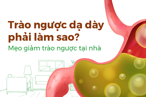 Trào ngược dạ dày phải làm sao? Mẹo giảm trào ngược tại nhà