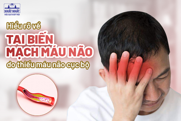 Hiểu rõ về tai biến mạch máu não do thiếu máu não cục bộ