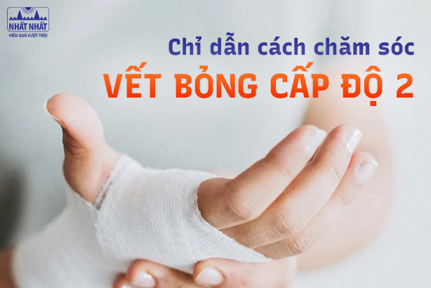 Chỉ dẫn cách chăm sóc vết bỏng cấp độ 2 tại nhà